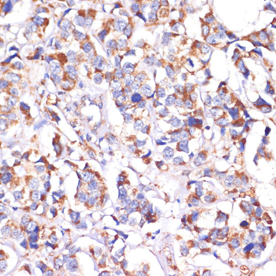 STOML2 Polyclonal Antibody (E-AB-63380)