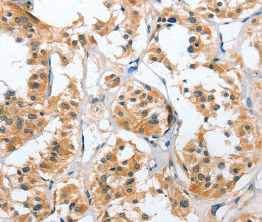 UGCG Polyclonal Antibody (E-AB-14100)