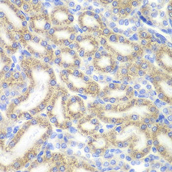 DAP Polyclonal Antibody (E-AB-61826)