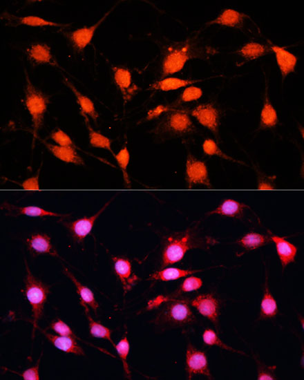 METTL3 Polyclonal Antibody (E-AB-63141)