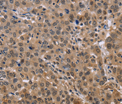 KIF25 Polyclonal Antibody (E-AB-14985)