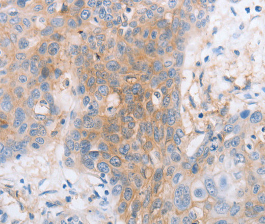 CD85d Polyclonal Antibody (E-AB-14170)
