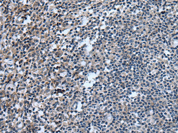 UGT8 Polyclonal Antibody (E-AB-53577)