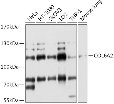 COL6A2 Polyclonal Antibody (E-AB-92552)