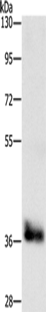 CEBP epsilon Polyclonal Antibody (E-AB-13997)
