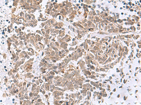 RBFOX2 Polyclonal Antibody (E-AB-52909)