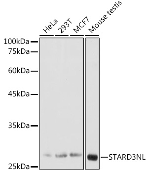 STARD3NL Polyclonal Antibody (E-AB-91584)