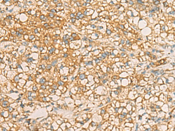 AIMP1 Polyclonal Antibody (E-AB-53139)