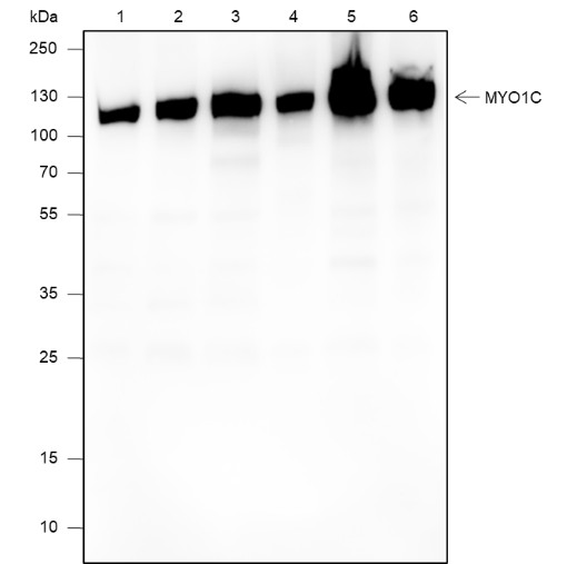 Recombinant MYO1C Monoclonal Antibody (AN301894L)