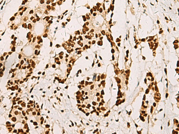 ELF5 Polyclonal Antibody (E-AB-19199)
