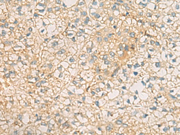 MRPL9 Polyclonal Antibody (E-AB-53129)