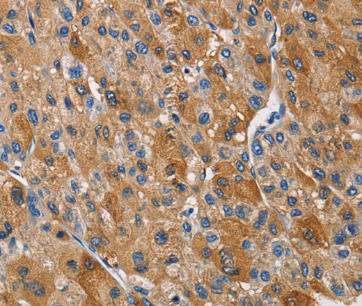 KLK1 Polyclonal Antibody (E-AB-14179)