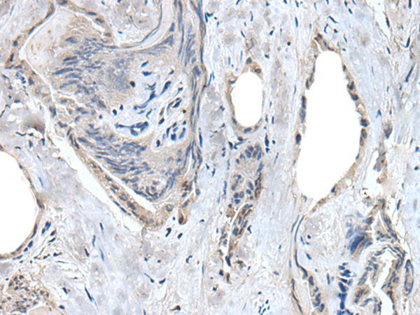 RASSF8 Polyclonal Antibody (E-AB-52206)