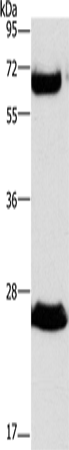 GGT1 Polyclonal Antibody (E-AB-11265)