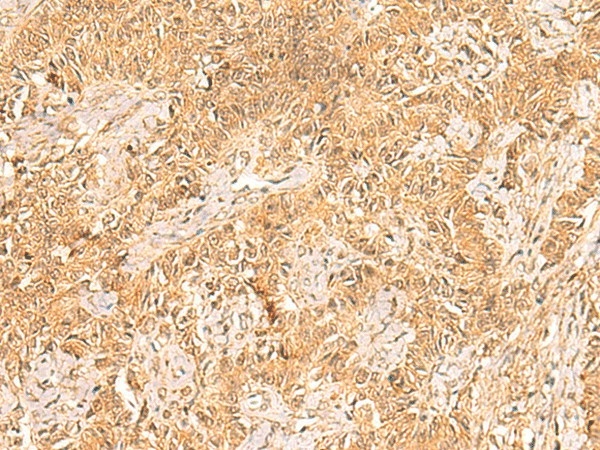 TRMT112 Polyclonal Antibody (E-AB-52004)