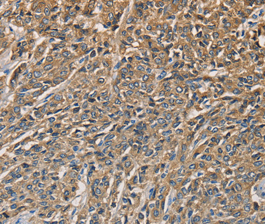 KLK1 Polyclonal Antibody (E-AB-10421)