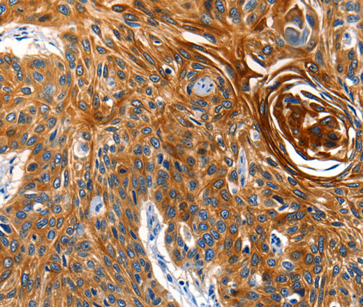 AQP5 Polyclonal Antibody (E-AB-15511)