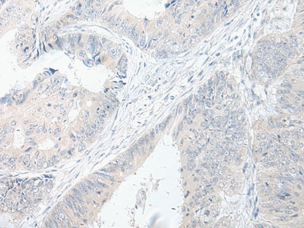 GPRASP2 Polyclonal Antibody (E-AB-52667)