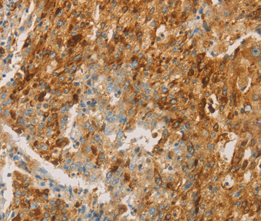 CEACAM8 Polyclonal Antibody (E-AB-10226)