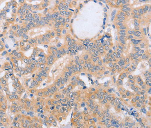 BST1 Polyclonal Antibody (E-AB-16287)