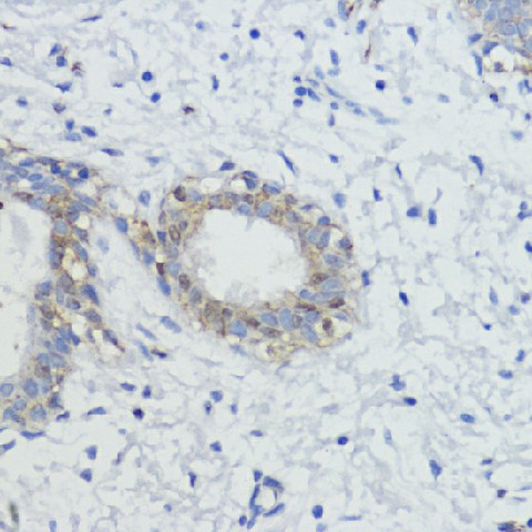 AKT Polyclonal Antibody (E-AB-63467)