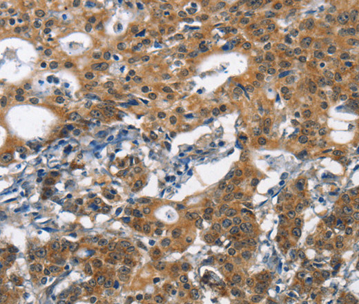 DCC Polyclonal Antibody (E-AB-15932)