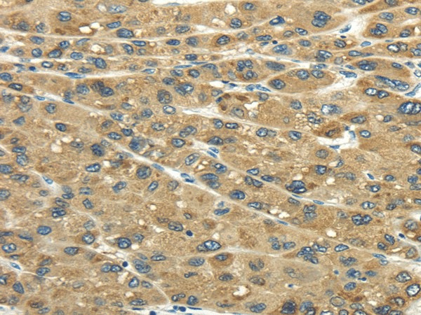 UGT2B4 Polyclonal Antibody (E-AB-17220)