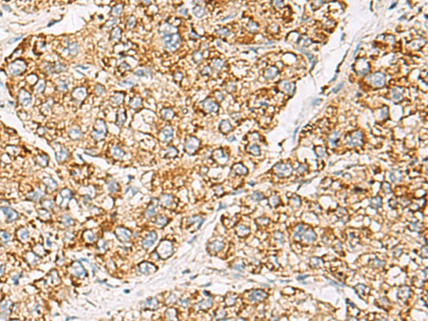 ZPBP2 Polyclonal Antibody (E-AB-52398)