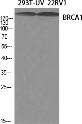 BRCA1 Polyclonal Antibody (E-AB-30669)