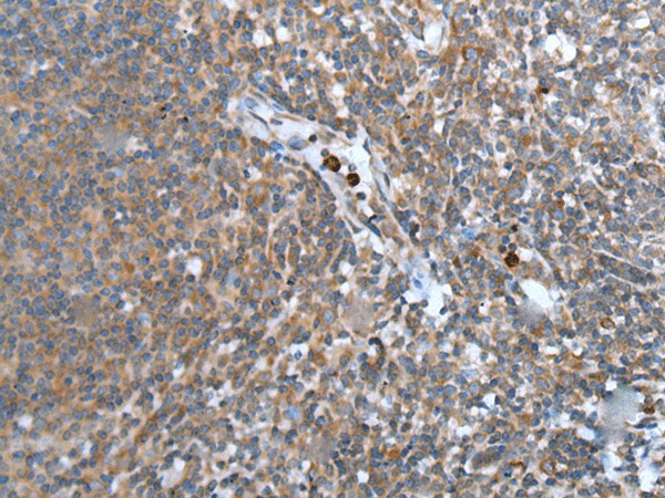 WISP2 Polyclonal Antibody (E-AB-53562)