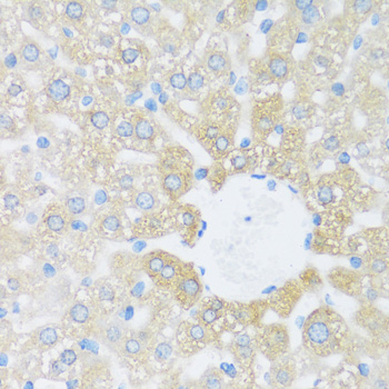 BRSK1 Polyclonal Antibody (E-AB-67083)
