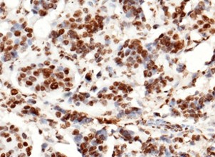Histone H3 Monoclonal Antibody (AN200152P)