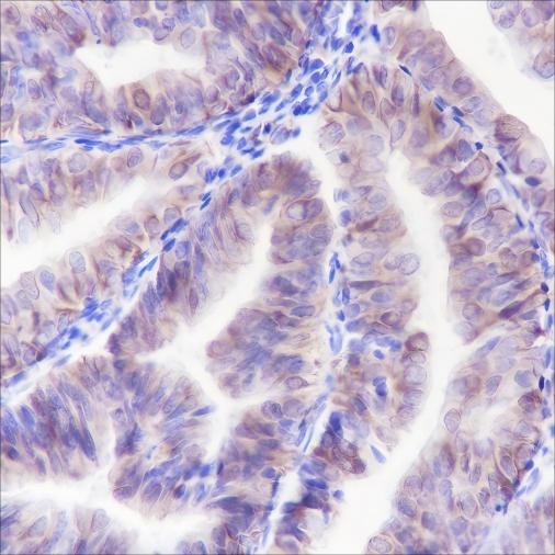 Recombinant ALOX15 Monoclonal Antibody (AN301432L)