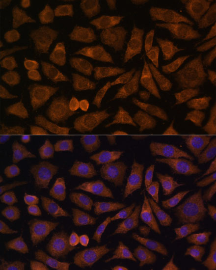 RABIF Polyclonal Antibody (E-AB-65194)