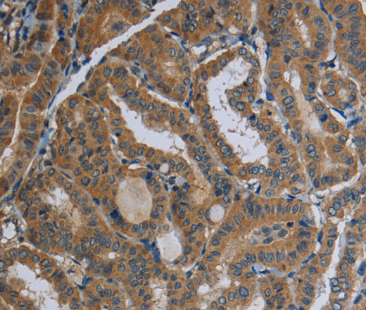FAAH Polyclonal Antibody (E-AB-11207)