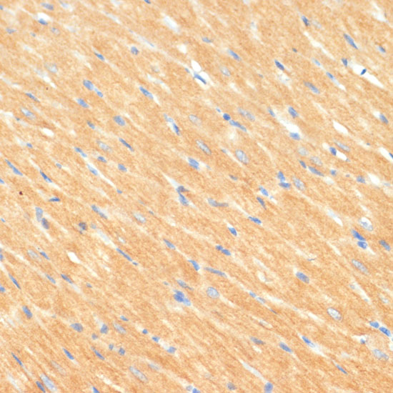 MYBPC3 Polyclonal Antibody (E-AB-63687)