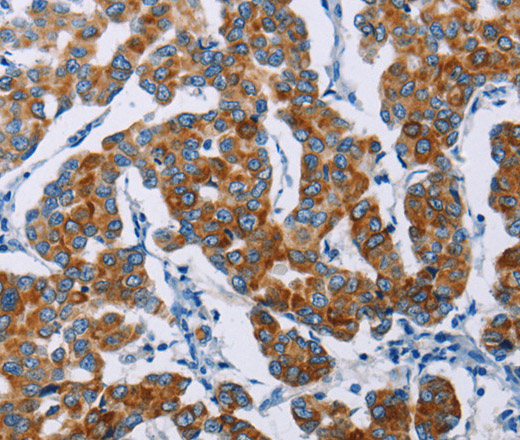 NCR3 Polyclonal Antibody (E-AB-14850)
