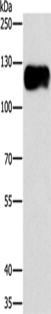 CAST Polyclonal Antibody (E-AB-11022)