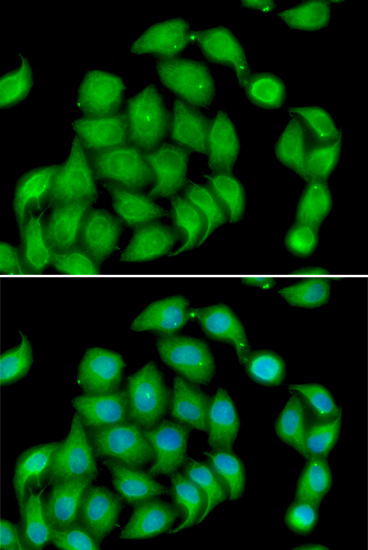 ASPH Polyclonal Antibody (E-AB-61378)