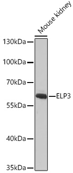 ELP3 Polyclonal Antibody (E-AB-68032)