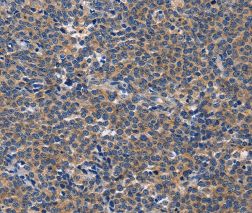 CD5L Polyclonal Antibody (E-AB-16326)