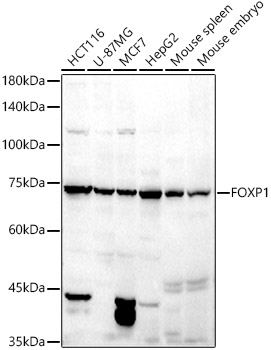 FOXP1 Polyclonal Antibody (E-AB-90453)