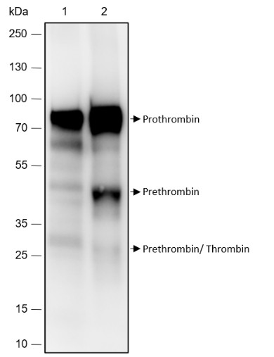 Recombinant Prothrombin Monoclonal Antibody (AN301787L)