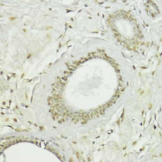 Snail Polyclonal Antibody (E-AB-63815)