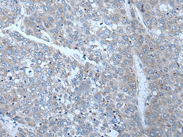 SLC24A5 Polyclonal Antibody (E-AB-19350)