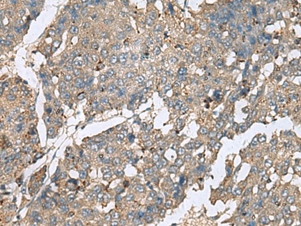 PLA2G2A Polyclonal Antibody (E-AB-19125)