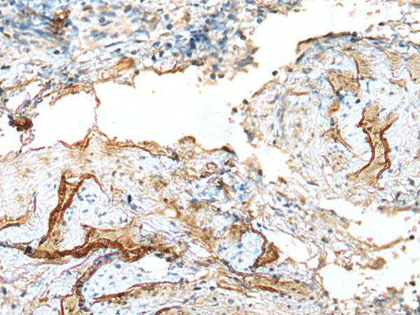 LDHD Polyclonal Antibody (E-AB-52194)