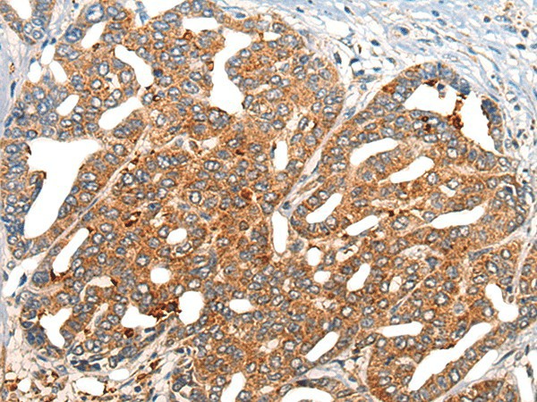 NOG Polyclonal Antibody (E-AB-19756)
