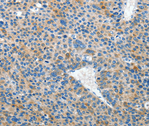 EPHB3 Polyclonal Antibody (E-AB-15955)