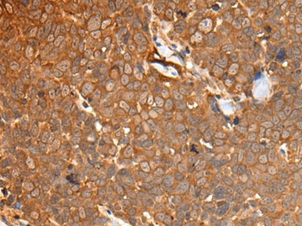 CAD Polyclonal Antibody (E-AB-19652)